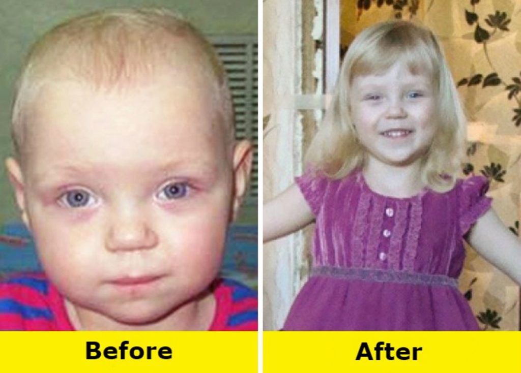 Может ли у ребенка поменяться. Дети из детдома до и после усыновления. Ребенок до и после. Детдомовские дети до и после. Фото детей до и после усыновления.
